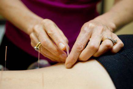 Dubbo Acupuncture & Carter Chiropractic - Lavinia 1