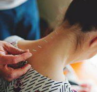 Scott Martin Acupuncture - Click Find