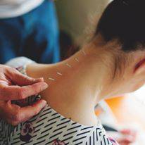 Scott Martin Acupuncture - Click Find 0