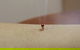 Acupuncture @ Beerwah - thumb 1