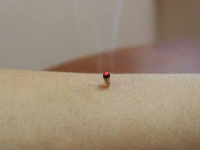 Acupuncture @ Beerwah - Local Finder 1