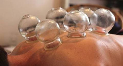 Acupuncture @ Beerwah - Local Finder 4