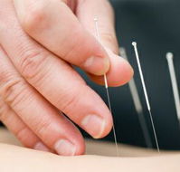 Kingscliff Acupuncture  Massage - Click Find