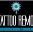 CQ Tattoo Removal Clinic - Bet 4u