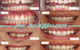 Fresh Dental Care - thumb 6