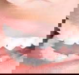 Ramana HarryDental Prosthetist - Click Find