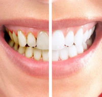 Graham Johnson Dental Surgeon - Lavinia