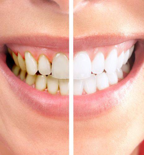 Graham Johnson Dental Surgeon - Bridge Guide 0