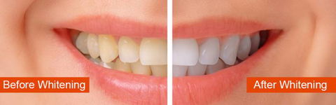 MS Dental Cardiff - Lavinia 1