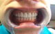 MS Dental Cardiff - thumb 3