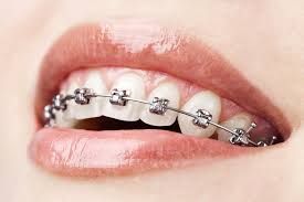 Dental Centre Buderim - Click Find 3