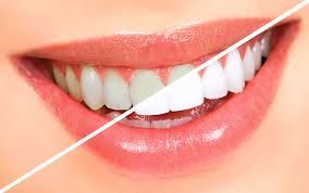 Dental Centre Buderim - Click Find 4