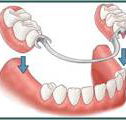 Denture Success - Click Find