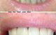 Your Dentist Gunnedah - thumb 0