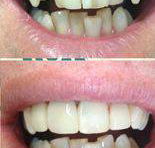Your Dentist Gunnedah - Click Find