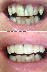 Your Dentist Gunnedah - Click Find 0