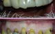 Your Dentist Gunnedah - thumb 1