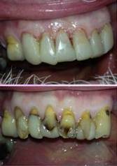 Your Dentist Gunnedah - Click Find 1