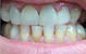 Your Dentist Gunnedah - thumb 3