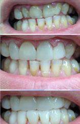 Your Dentist Gunnedah - Click Find 3
