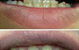 Your Dentist Gunnedah - thumb 4