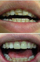 Your Dentist Gunnedah - Click Find 4