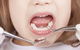 Balgownie Dental Surgery - thumb 3