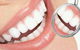 Balgownie Dental Surgery - thumb 4