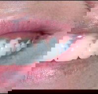 Active Denture Clinic - Click Find