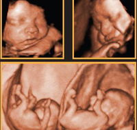 Sarina Medical Imaging - Click Find