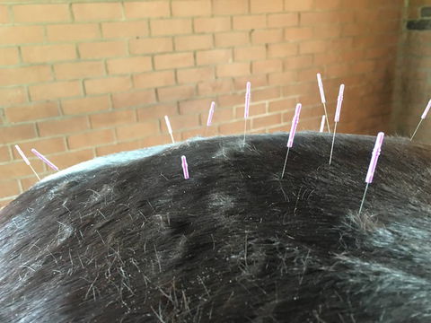 Ben Walder Horse Acupuncture & Iridology - Click Find 3