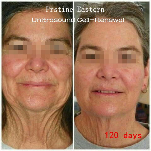 PRISTINE EASTERN Chinese Herbal Massage And Beauty Clinic - Click Find 0