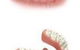 Precise Dentures – Blair Grundy Denture Clinic - thumb 2