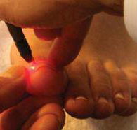 Mullumbimby Podiatry Laser Clinic - Click Find