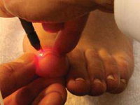 Mullumbimby Podiatry Laser Clinic