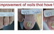 Mullumbimby Podiatry Laser Clinic - thumb 1